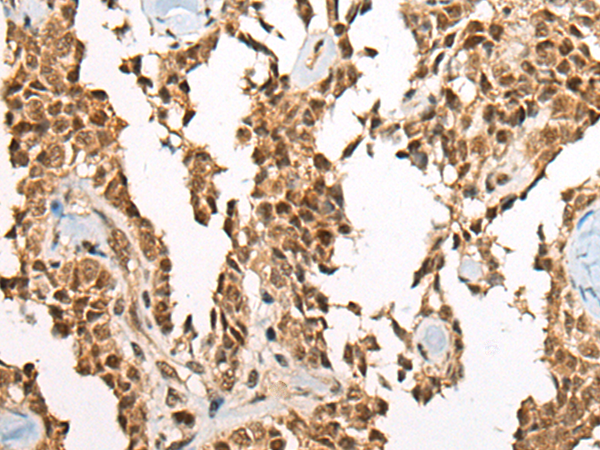 Rabbit Polyclonal Antibody to ATE1