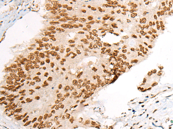 Rabbit Polyclonal Antibody to ATN1