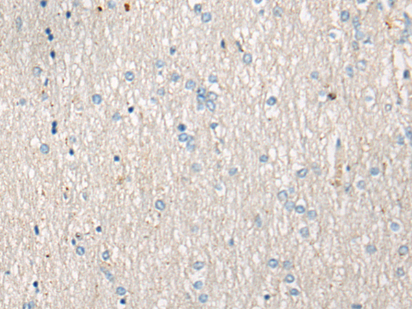Rabbit Polyclonal Antibody to AVPR1B