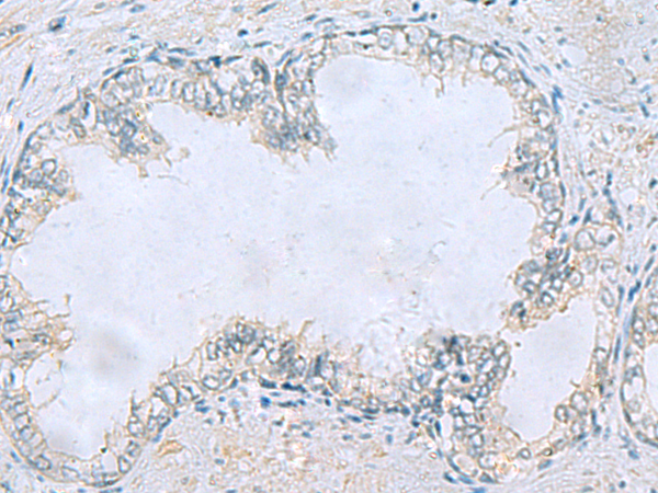 Rabbit Polyclonal Antibody to CEP131