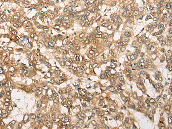 Rabbit Polyclonal Antibody to B3GALT6