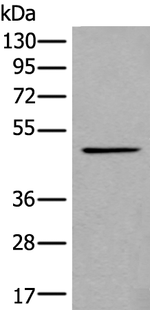 Rabbit Polyclonal Antibody to B4GAT1