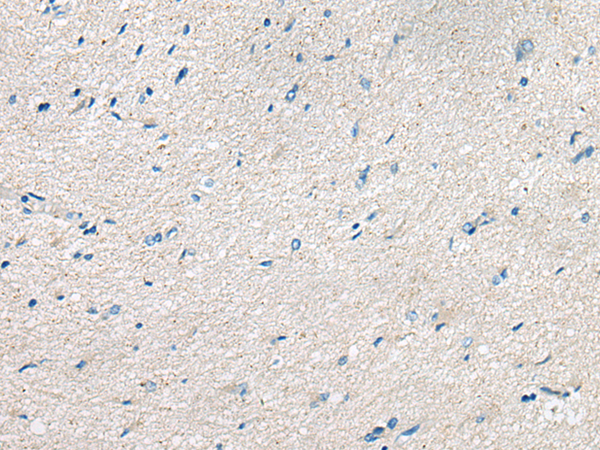 Rabbit Polyclonal Antibody to BACE2