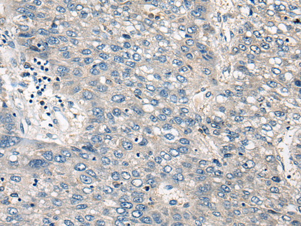 Rabbit Polyclonal Antibody to BBS12