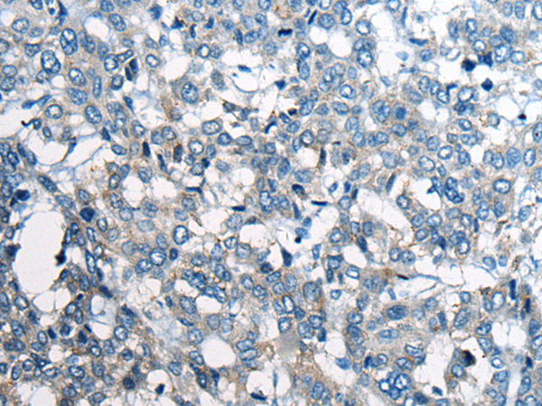 Rabbit Polyclonal Antibody to BCL2L2