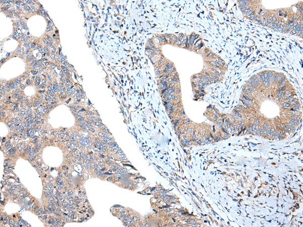 Rabbit Polyclonal Antibody to SNCB