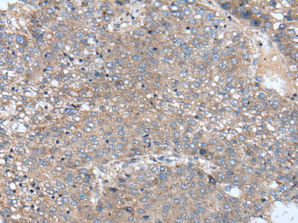Rabbit Polyclonal Antibody to BICD1