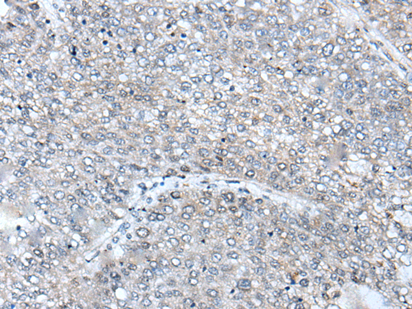 Rabbit Polyclonal Antibody to BICD2