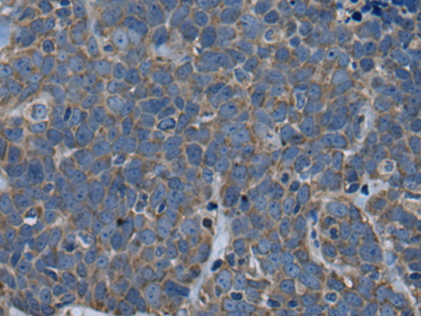 Rabbit Polyclonal Antibody to ARFGEF1