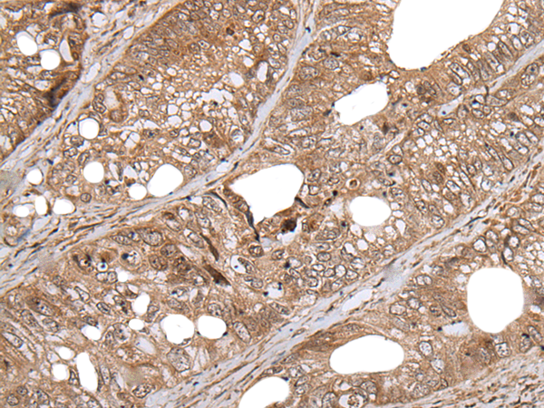 Rabbit Polyclonal Antibody to BLM