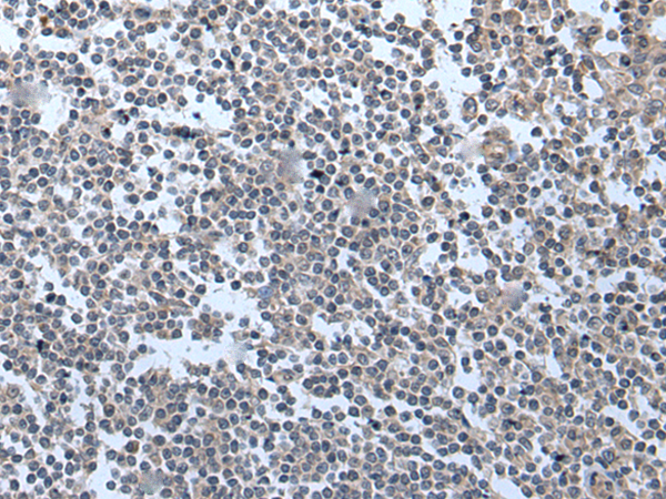 Rabbit Polyclonal Antibody to BMP1