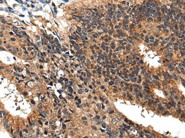 Rabbit Polyclonal Antibody to BMPER