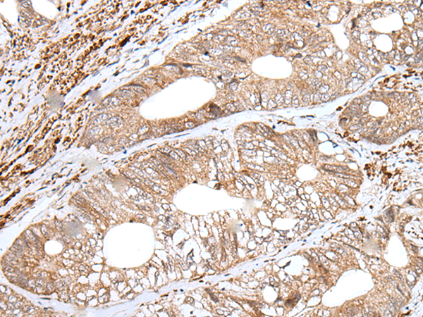 Rabbit Polyclonal Antibody to ENPEP