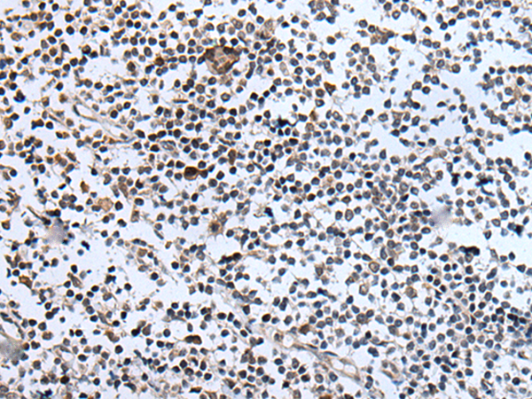 Rabbit Polyclonal Antibody to BRD3