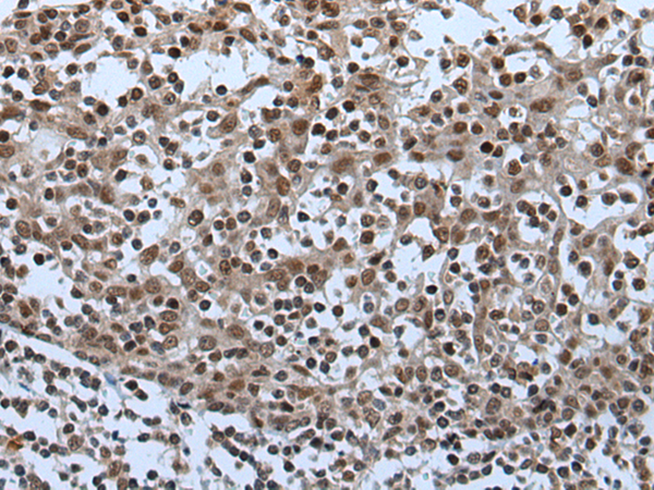 Rabbit Polyclonal Antibody to CELF5