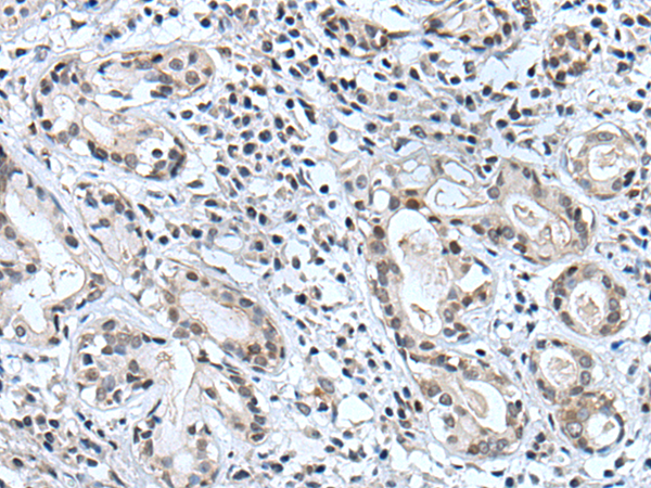 Rabbit Polyclonal Antibody to BSPRY