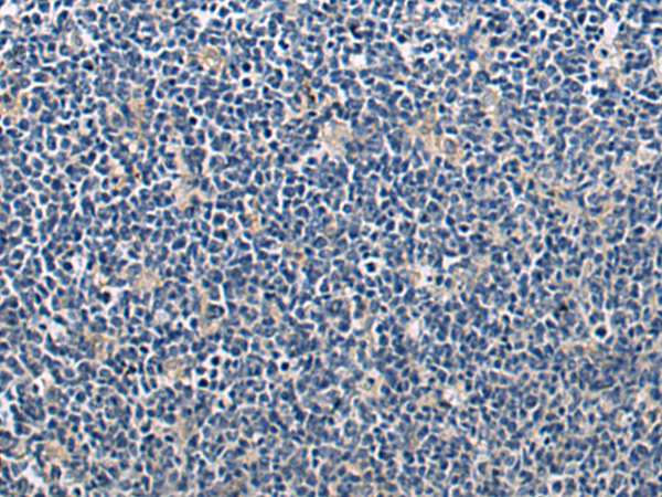 Rabbit Polyclonal Antibody to ATG7