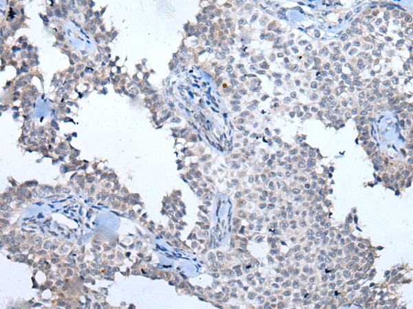 Rabbit Polyclonal Antibody to ATM
