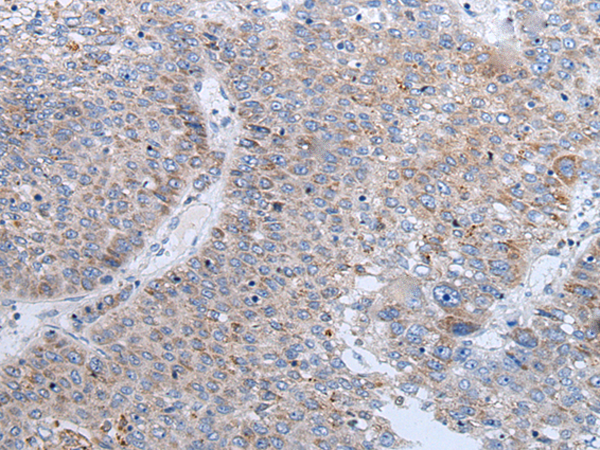 Rabbit Polyclonal Antibody to ENPP2
