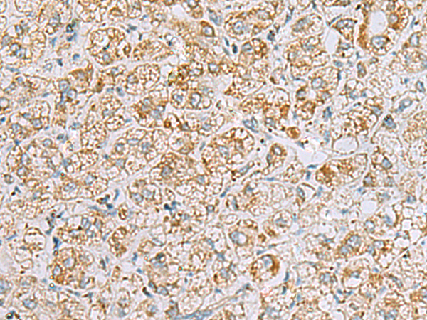 Rabbit Polyclonal Antibody to INS(C-peptide)