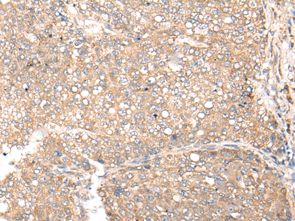 Rabbit Polyclonal Antibody to CDC123