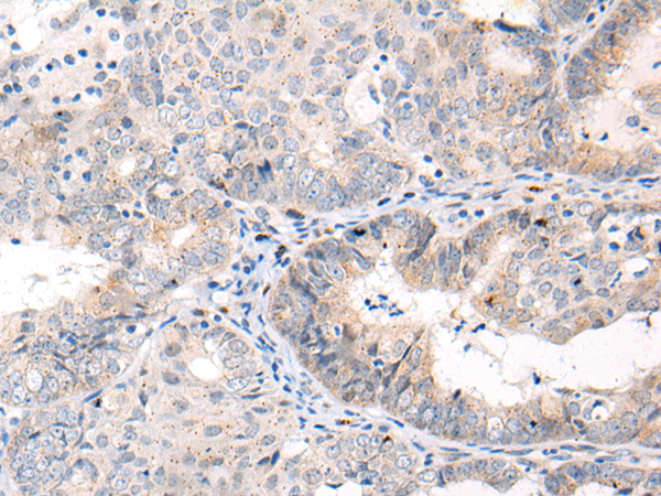 Rabbit Polyclonal Antibody to ANAPC15