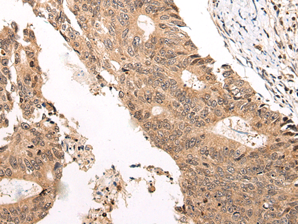Rabbit Polyclonal Antibody to CHAMP1