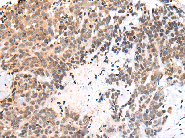 Rabbit Polyclonal Antibody to RIOX1