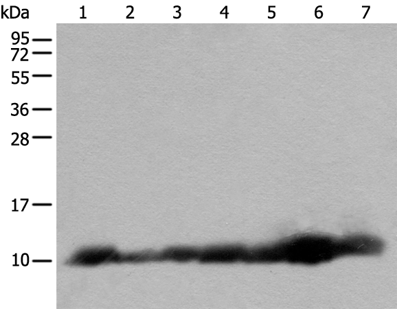 Rabbit Polyclonal Antibody to ATP5MPL