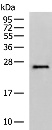 Rabbit Polyclonal Antibody to EMC7