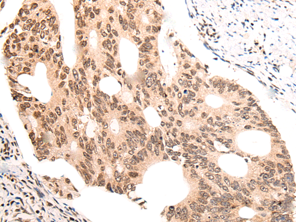 Rabbit Polyclonal Antibody to KNOP1