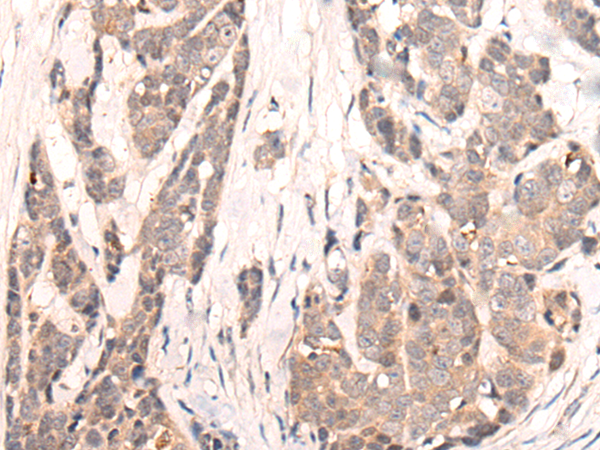 Rabbit Polyclonal Antibody to SIGLECL1