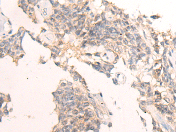 Rabbit Polyclonal Antibody to IBA57