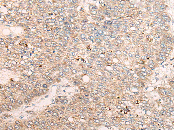 Rabbit Polyclonal Antibody to C1S