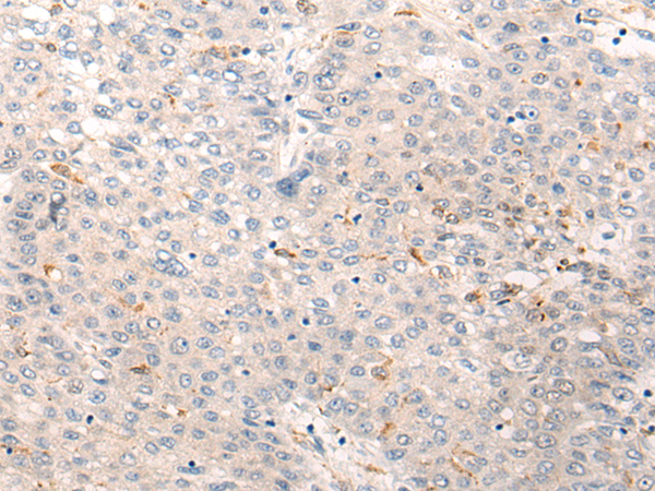 Rabbit Polyclonal Antibody to SOGA1