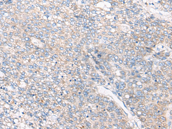 Rabbit Polyclonal Antibody to C3/C3b