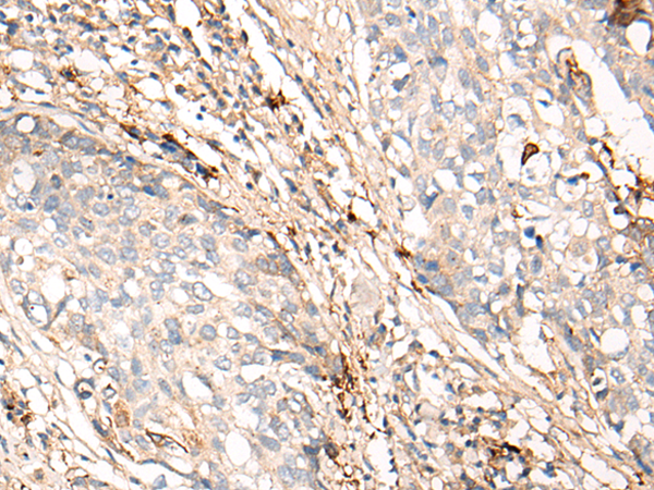 Rabbit Polyclonal Antibody to C4BPA