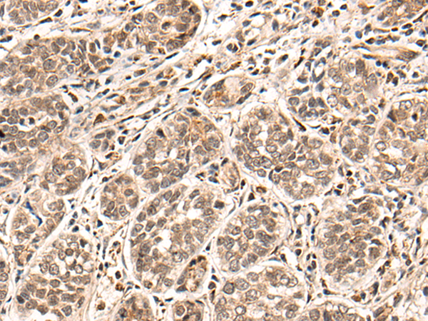 Rabbit Polyclonal Antibody to HGH1