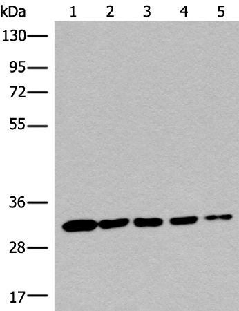 Rabbit Polyclonal Antibody to CA5A