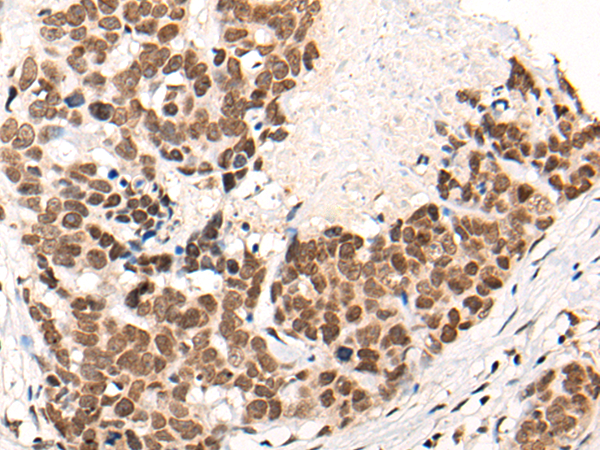 Rabbit Polyclonal Antibody to CACNA1H