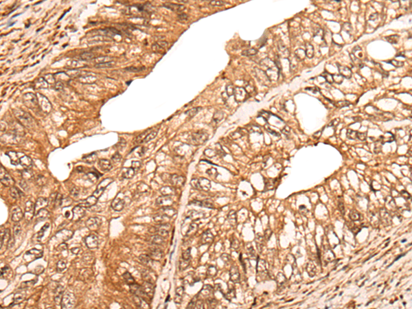 Rabbit Polyclonal Antibody to CACNA2D2