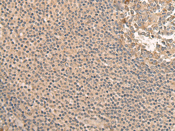 Rabbit Polyclonal Antibody to CALB1