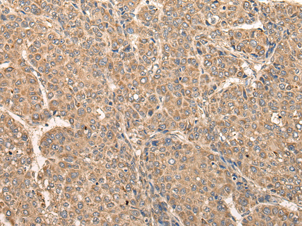 Rabbit Polyclonal Antibody to RCAN3