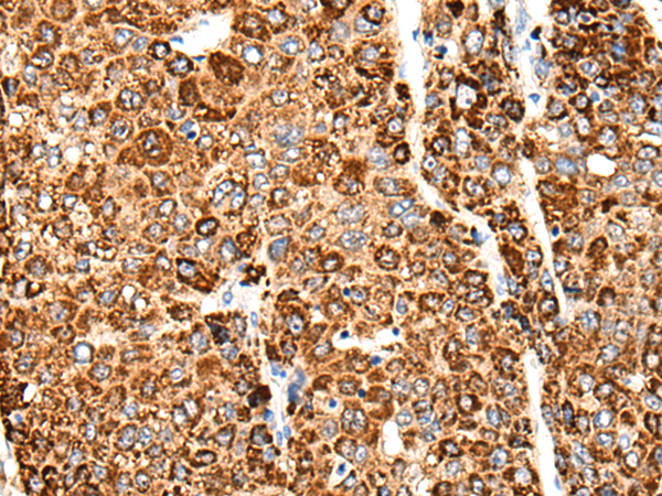 Rabbit Polyclonal Antibody to CACNG5
