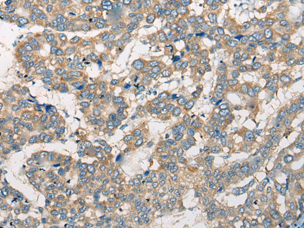 Rabbit Polyclonal Antibody to CCIN