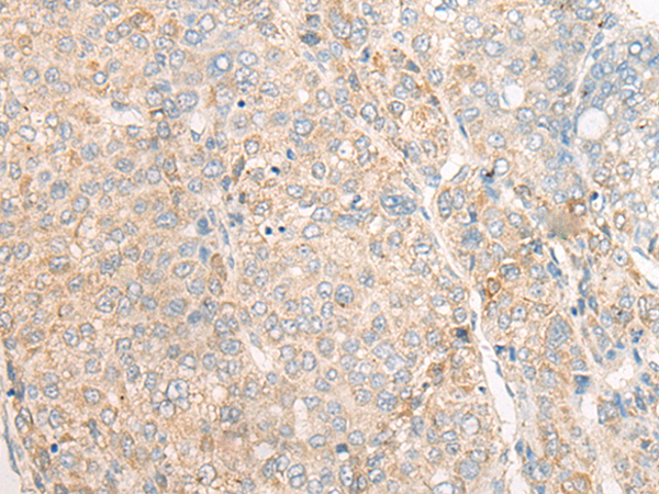 Rabbit Polyclonal Antibody to CALML6