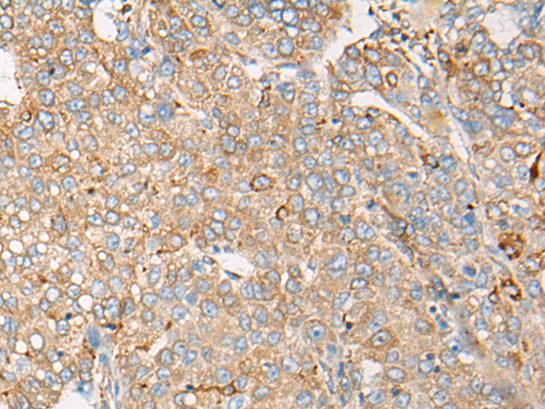 Rabbit Polyclonal Antibody to CAPN9