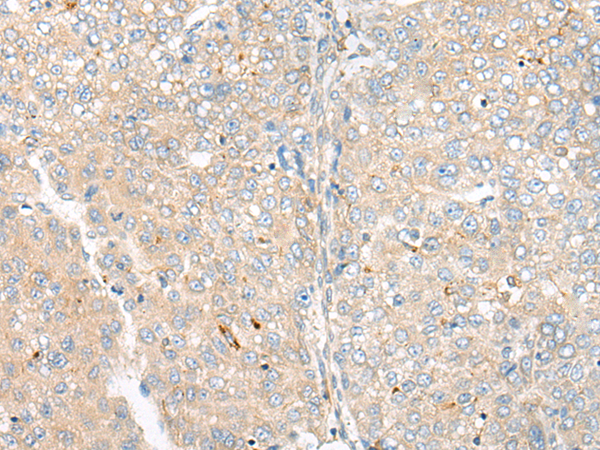 Rabbit Polyclonal Antibody to CAMK2A