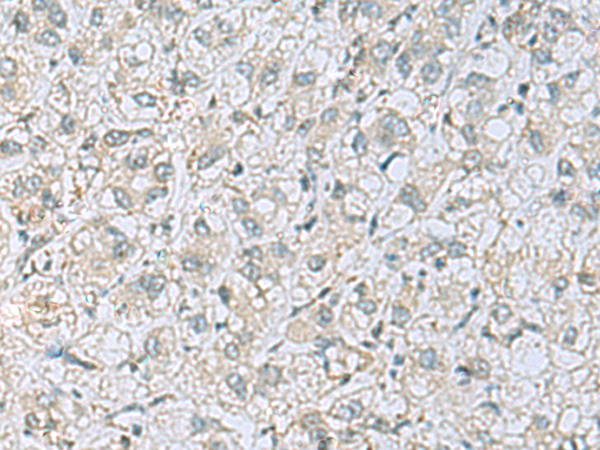 Rabbit Polyclonal Antibody to CAMK2G