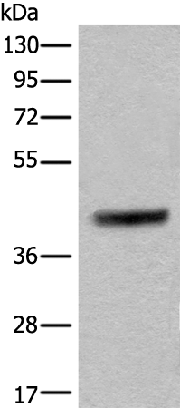 Rabbit Polyclonal Antibody to PRKACA